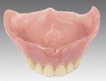 総入れ歯（プラスティック樹脂）イメージ