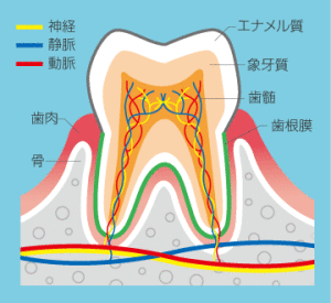 caries1_1